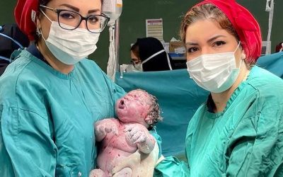 سزارین تکراری: بررسی شرایط، عوارض و خطرات