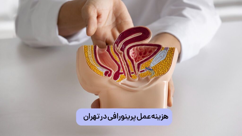 هزینه پرینورافی در تهران